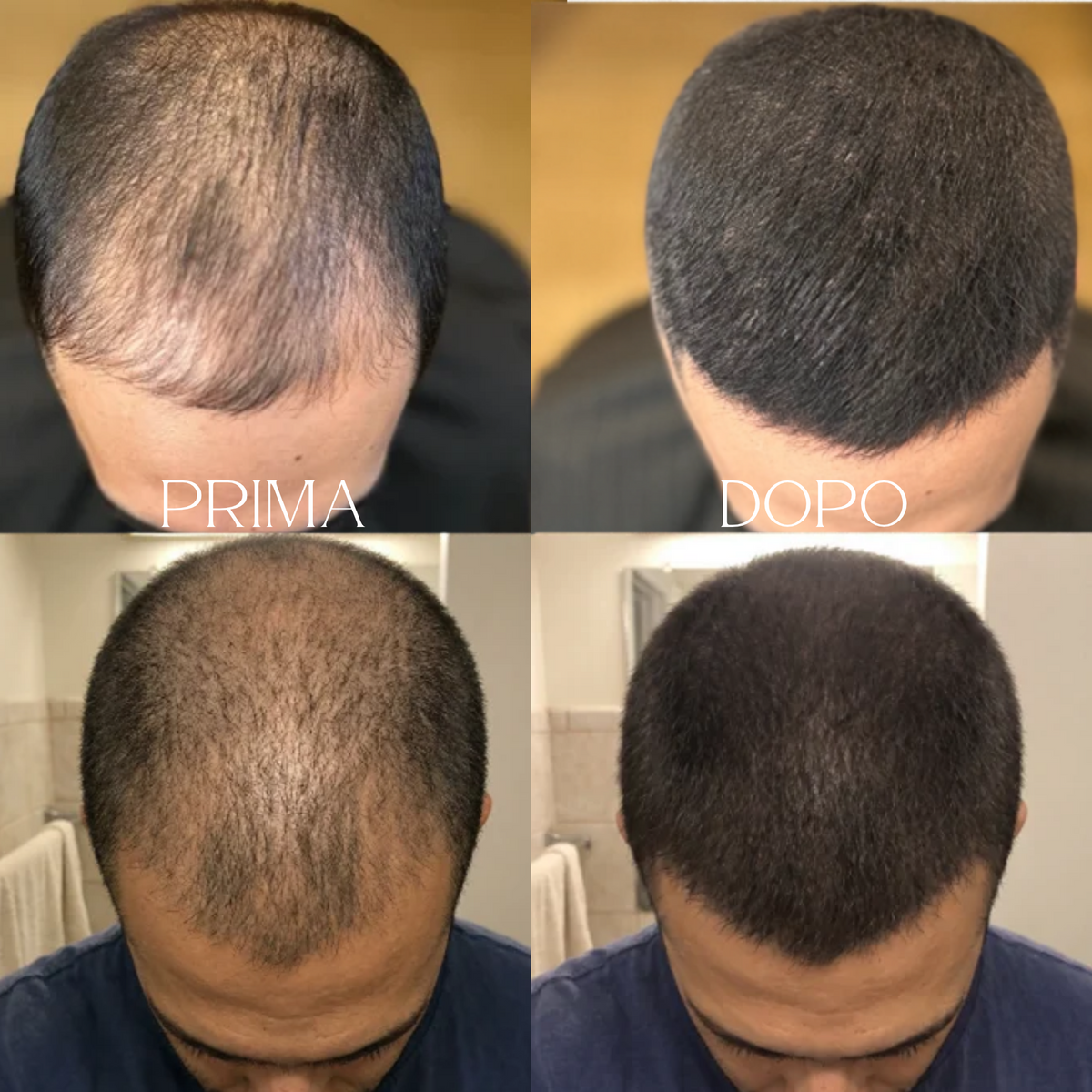 Invisò™ Capelli Più Pieni in 10 Secondi