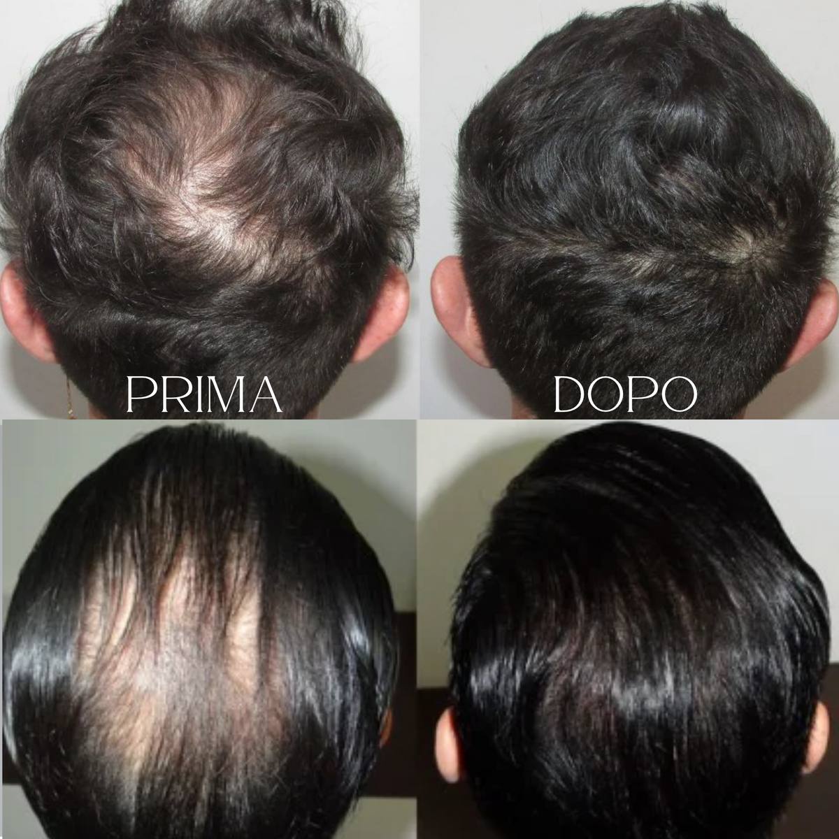 Invisò™ Capelli Più Pieni in 10 Secondi
