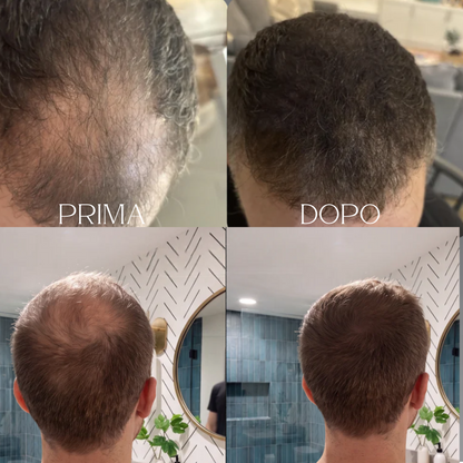 Invisò™ Capelli Più Pieni in 10 Secondi