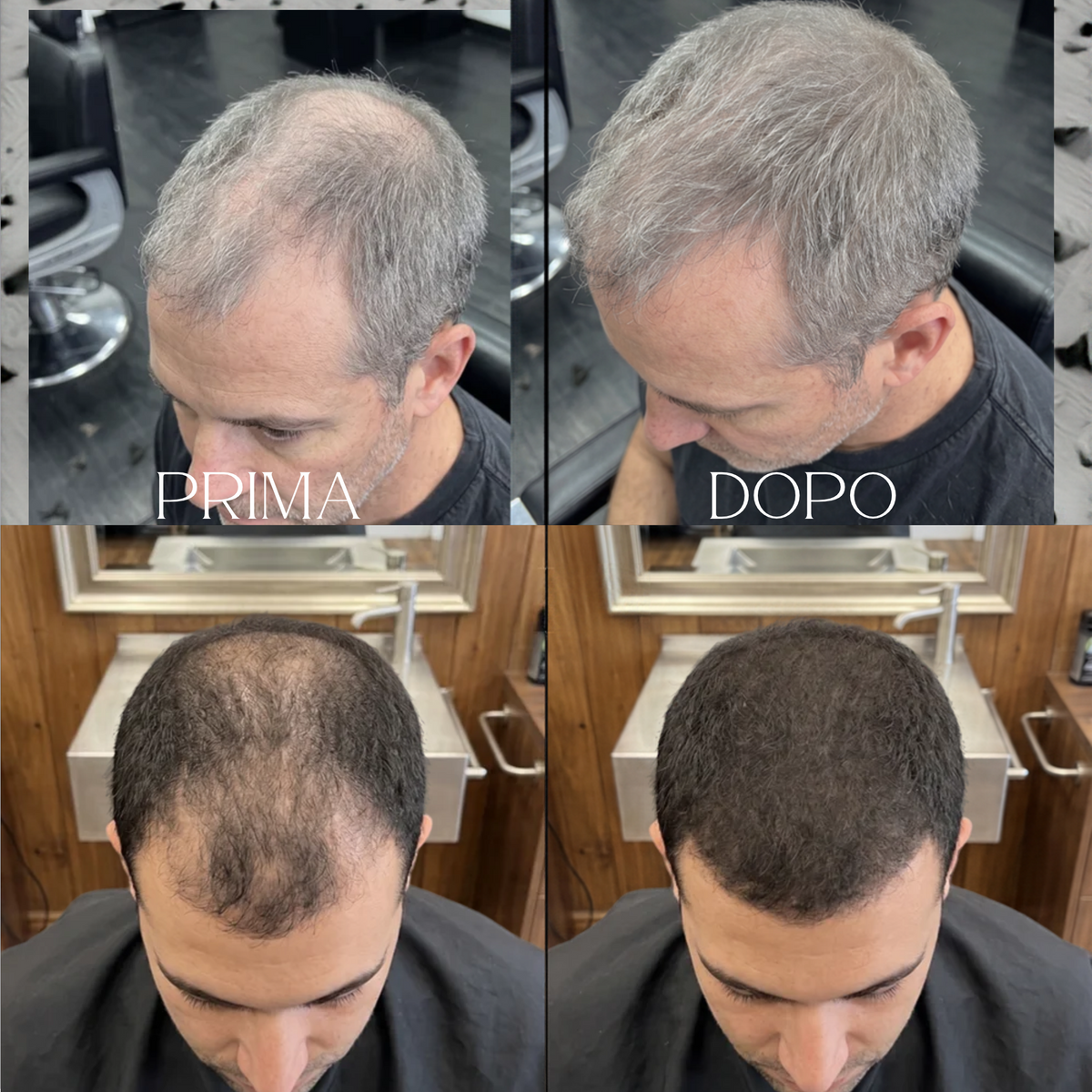 Invisò™ Capelli Più Pieni in 10 Secondi